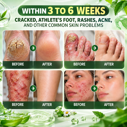 MOPRO® 30 Herbal Repair & Detox Foot Bath Beads🦶 transform your daily foot care routine into a relaxing and enjoyable at-home spa experience🏠🛁